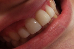 Boding Ρητίνης Μετά