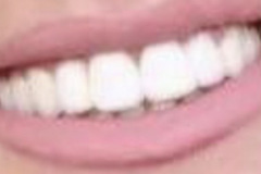 Boding Ρητίνης Μετά