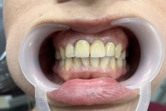 IMG-4f6aaa458b968cc9ce0c342a69eacb7e-V