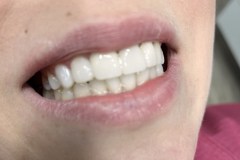 IMG-f20ce211b2dfd000fce881c5fc8a3035-V