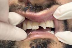 IMG-3f74c733e9105158ccaecf3e3db6489a-V