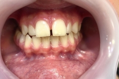 SmartSelect_20220317-204250_Instagram