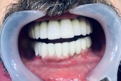 IMG-7edcdc4106ac9cc792fa0c81661186a5-V