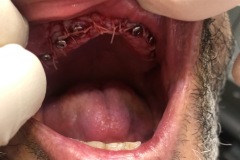 IMG-efc65befe1c7380c15d1114cfed62fc2-V