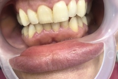 IMG-52d4faf6c23c06b94c4aa849efd81aa9-V