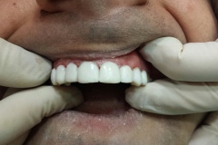IMG-39de2f9d9f35fbf71d6003ca3766445d-V
