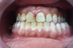 IMG-ef20bc66c1420f99b57fc73403566314-V