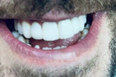 IMG-0948e6cea420fa7c664ed5ddd4198b42-V