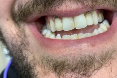 IMG-40b9f4b795a539db9615660cedece340-V