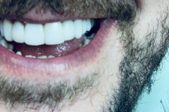 IMG-a790a9972c05b5fa1f2cadd8d4404003-V