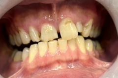 IMG-3ac158a63273c100b4eae7727bf6496f-V