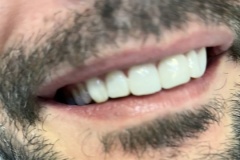 IMG-5093fcdbe3c42f01621ee1e69cae930d-V