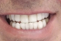 IMG-03392cc9bfd0370871746135bfb0d20a-V