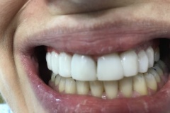 IMG-d4782bfd749a3acf1c8d590c1c793f47-V