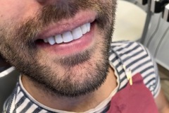 IMG-9664582757c681fe3df73368c538f7dc-V