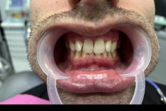 IMG-c65056320b45abbe568e9b6a0d1f38ec-V