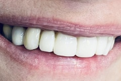 IMG-19f007abc728da38e508dc2c181a7afa-V