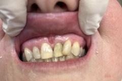 IMG-a8c7384896d611171ea2cb134c37f1cd-V