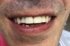 IMG-3b77ab5adc0974d0604bc629dcb281b4-V