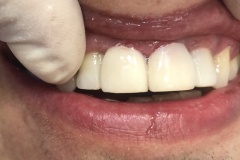 IMG-5cb3cd0f3dddbffdb5bfaa304402bf07-V