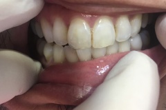 IMG-4bd3c581ff7d90a1a98512f7b3848b54-V