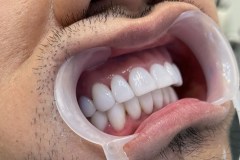 IMG-6c4ef7eecb2a147853438444fab6366c-V