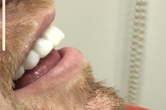 IMG-7b14de56c93296191ff7863072202891-V