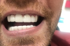 IMG-955db479f70395bbb2f521200e8e7638-V