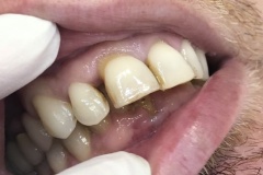 IMG-9ba449d81fa569a61d318c20a96b6f32-V