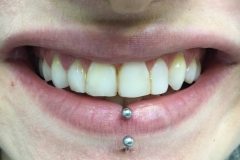 συνθέτη-ρητίνη1