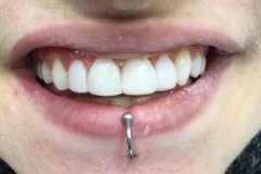 συνθέτη-ρητίνη2