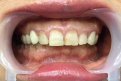 συνθέτη-ρητίνη3