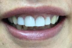 συνθέτη-ρητίνη4