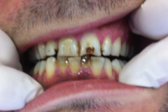 Όψεις-ρητίνης-μια-συνέδρια1