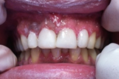 Όψεις-ρητίνης-μια-συνέδρια2